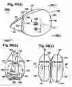 Fig. 22 - Twin airbag