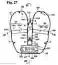 Fig. 23 - Twin airbag
