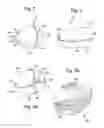Fig. 03 - Adaptive depth airbag
