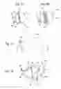Fig. 04 - Adaptive depth airbag