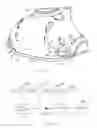 Fig. 10 - Hollow structure formed by rotational molding and method of manufacturing same