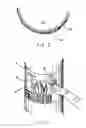 Fig. 03 - Scratch-off coating area for application of indicia by users of consumable products