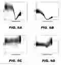 Fig. 06 - Iterative decomposition of water and fat with echo asymmetry and least square estimation