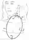 Fig. 01 - Article with battery-illuminated medallion