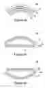 Fig. 06 - Fiber illumination system for back lighting