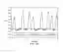 Fig. 06 - Drilling fluid pressure pulse detection using a differential transducer