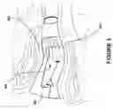 Fig. 04 - Conjoined receiver and microphone assembly