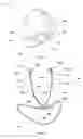 Fig. 02 - Retainable hearing aid and method thereof