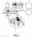 Fig. 02 - Imaging system for interventional radiology