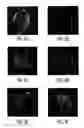 Fig. 06 - Method and apparatus for generating a 2D image having pixels corresponding to voxels of a 3D image