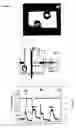 Fig. 03 - Integrated electrical and optical sensor for biomolecule analysis with single molecule sensitivity