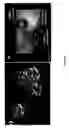 Fig. 22 - Integrated electrical and optical sensor for biomolecule analysis with single molecule sensitivity