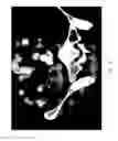 Fig. 02 - Composition and method for direct visualization of the human appendix