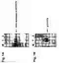 Fig. 02 - Packaged virus-like particles