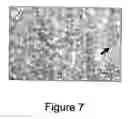 Fig. 08 - Encapsulated cell therapy