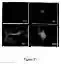 Fig. 22 - Encapsulated cell therapy