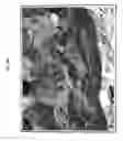 Fig. 06 - Employment of rotavirus proteins, derived proteins and peptides for the modulation of tissue permeability