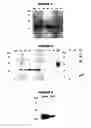 Fig. 04 - Multiple variants of meningococcal protein nmb1870