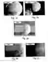 Fig. 02 - Agent-encapsulating micro- and nanoparticles, methods for preparation of same and products containing same