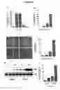 Fig. 04 - Agents and methods for enhancing bone formation by oxysterols in combination with bone morphogenic proteins