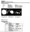 Fig. 06 - Rice flour composition with enhanced process tolerance and solution stability