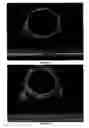 Fig. 04 - Process for obtaining silicon nitride (SIN) surface coatings on ceramic components and pieces