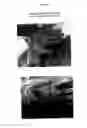 Fig. 08 - Repellent elastomeric article