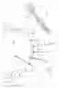 Fig. 02 - Method and apparatus for positioning an orthodontic appliance