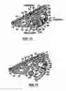 Fig. 07 - Orthodontic devices for use with arch wires