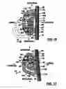 Fig. 09 - Orthodontic devices for use with arch wires