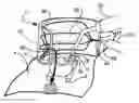 Fig. 01 - Process for capture and removal of abrasive material for gas abrasive applications