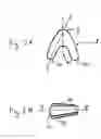 Fig. 03 - Dental insertion element of non-cylindrical shape