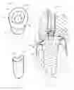 Fig. 03 - Slanted dental implant