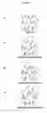 Fig. 07 - Nucleic acids encoding mutations in sodium channels related to epilepsy