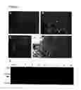 Fig. 02 - Methods and compositions for generating human monoclonal antibodies