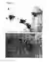 Fig. 03 - Methods and compositions for generating human monoclonal antibodies