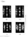 Fig. 09 - Process for producing GaN substrate