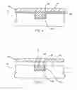 Fig. 04 - Slurry for use in polishing semiconductor device conductive structures that include copper and tungsten and polishing methods
