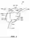 Fig. 03 - Multiple degree of freedom compliant mechanism