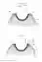 Fig. 04 - Air supply device