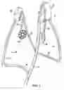 Fig. 02 - Swing assembly