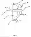 Fig. 19 - Elevated golf club foot