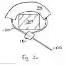 Fig. 23 - Racket bumper guard