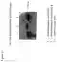 Fig. 13 - Methods and compositions for the treatment and prevention of staphylococcus and other bacterial infections