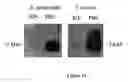 Fig. 14 - Methods and compositions for the treatment and prevention of staphylococcus and other bacterial infections