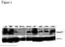 Fig. 02 - Combined therapy utilizing reduction of DNA methyltransferase expression and/or activity and interferon