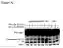 Fig. 07 - Combined therapy utilizing reduction of DNA methyltransferase expression and/or activity and interferon