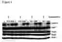 Fig. 08 - Combined therapy utilizing reduction of DNA methyltransferase expression and/or activity and interferon