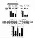 Fig. 07 - Small molecule Bcl-xL/Bcl-2 binding inhibitors