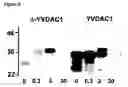 Fig. 11 - Mitochrondrial permeability transition pore affinity labels and modulators